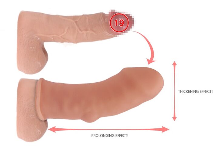 dzimumlocekļa palielināšana ar uzgali